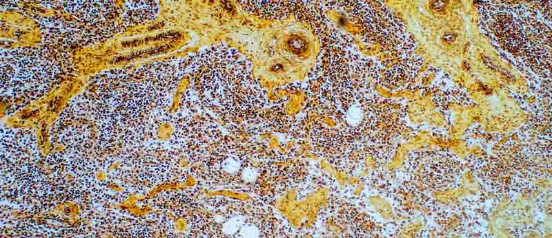Cells showing liver scarring and how NMN helps improve their health
